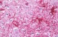 JAKMIP1 Antibody (Internal)